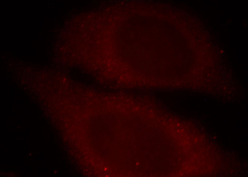 Immunofluorescent analysis of Hela cells, using TSC2 antibody Catalog No:116485 at 1:25 dilution and Rhodamine-labeled goat anti-rabbit IgG (red).
