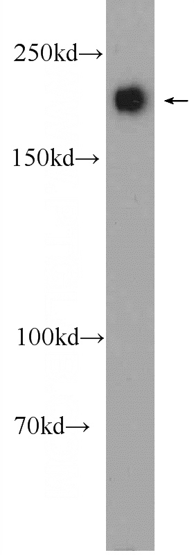 HEK-293 cells were subjected to SDS PAGE followed by western blot with Catalog No:116484(TSC2 Antibody) at dilution of 1:300