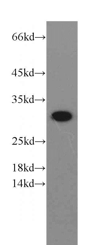 HepG2 cells were subjected to SDS PAGE followed by western blot with Catalog No:117344(VDAC1 antibody) at dilution of 1:600