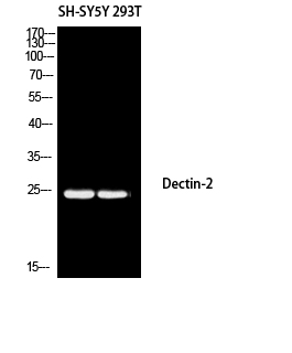 Fig1:; Western blot analysis of SH-SY5Y 293T using Dectin-2 antibody. Antibody was diluted at 1:1000. Secondary antibody（catalog#: HA1001) was diluted at 1:20000