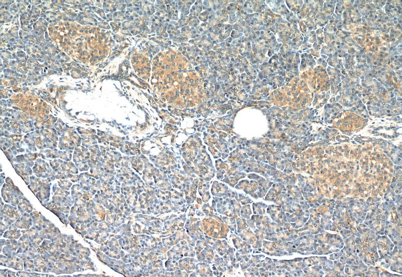 Immunohistochemistry of paraffin-embedded human pancreas tissue slide using Catalog No:116484(TSC2 Antibody) at dilution of 1:50 (under 10x lens)