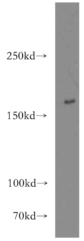 mouse lung tissue were subjected to SDS PAGE followed by western blot with Catalog No:116485(TSC2-Specific antibody) at dilution of 1:300
