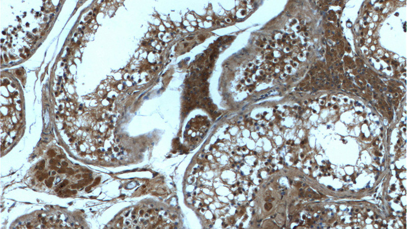 Immunohistochemistry of paraffin-embedded human testis tissue slide using Catalog No:107533(USP13 Antibody) at dilution of 1:200 (under 10x lens)