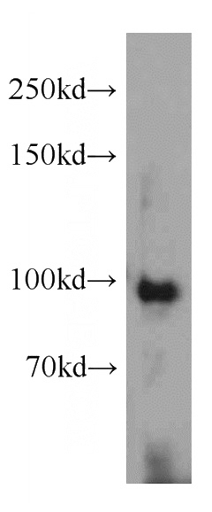 HepG2 cells were subjected to SDS PAGE followed by western blot with Catalog No:107533(USP13 Antibody) at dilution of 1:1000