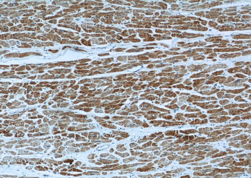Immunohistochemical of paraffin-embedded human heart using Catalog No:117344(VDAC1 antibody) at dilution of 1:50 (under 10x lens)