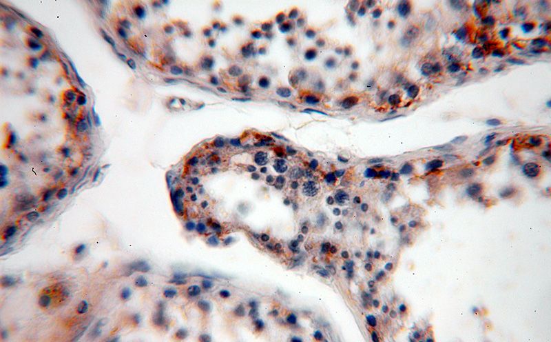 Immunohistochemical of paraffin-embedded human testis using Catalog No:113971(PLK4 antibody) at dilution of 1:200 (under 40x lens)