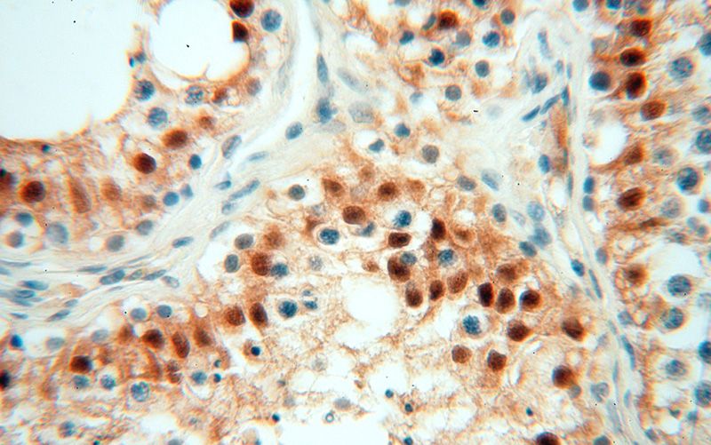 Immunohistochemical of paraffin-embedded human testis using Catalog No:116590(USP13 antibody) at dilution of 1:50 (under 40x lens)