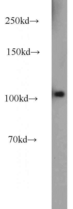 mouse lung tissue were subjected to SDS PAGE followed by western blot with Catalog No:113971(PLK4 antibody) at dilution of 1:2000