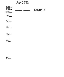 Fig1:; Western blot analysis of A549 3T3 using Tensin-2 antibody. Antibody was diluted at 1:500. Secondary antibody（catalog#: HA1001) was diluted at 1:20000