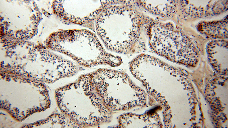 Immunohistochemical of paraffin-embedded human testis using Catalog No:113971(PLK4 antibody) at dilution of 1:200 (under 10x lens)