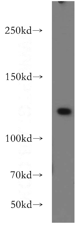 HEK-293 cells were subjected to SDS PAGE followed by western blot with Catalog No:116543(UBE4A antibody) at dilution of 1:500