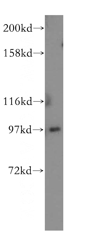 HEK-293 cells were subjected to SDS PAGE followed by western blot with Catalog No:116590(USP13 antibody) at dilution of 1:400