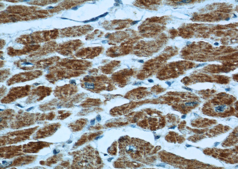 Immunohistochemical of paraffin-embedded human heart using Catalog No:117344(VDAC1 antibody) at dilution of 1:50 (under 40x lens)