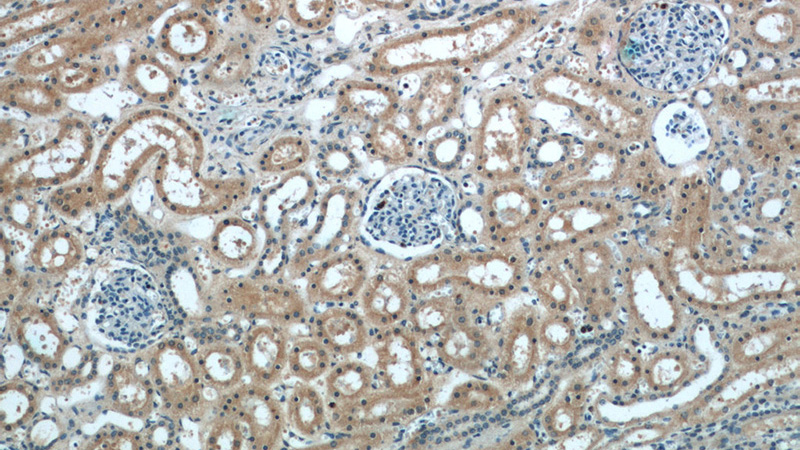 Immunohistochemistry of paraffin-embedded human kidney slide using Catalog No:116485(TSC2-Specific Antibody) at dilution of 1:50