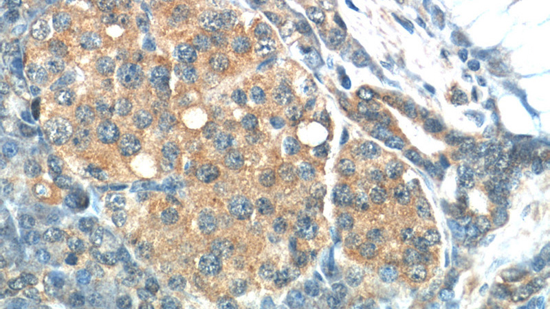 Immunohistochemistry of paraffin-embedded human pancreas tissue slide using Catalog No:116484(TSC2 Antibody) at dilution of 1:50 (under 40x lens)