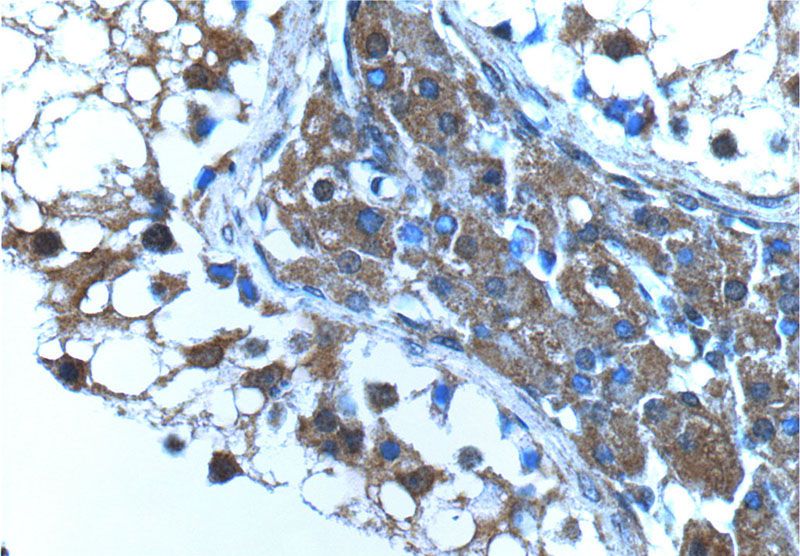 Immunohistochemistry of paraffin-embedded human testis tissue slide using Catalog No:107533(USP13 Antibody) at dilution of 1:200 (under 40x lens)