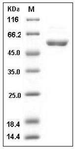 Human CDC2 Kinase / CDK1 Protein (GST Tag) SDS-PAGE