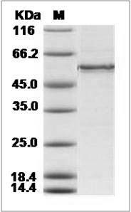 Human CDC2 & CCNE1 Heterotrimer Protein SDS-PAGE