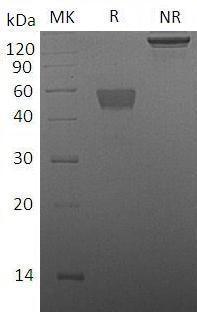 Mouse TIGIT (Fc tag) recombinant protein