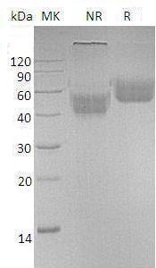 Human IL1R1/IL1R/IL1RA/IL1RT1 (His tag) recombinant protein