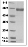 Influenza B Neuraminidase Protein 14967