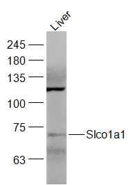 Fig2: Sample:; Liver (Mouse) Lysate at 40 ug; Primary: Anti-Slco1a1 at 1/1000 dilution; Secondary: IRDye800CW Goat Anti-Rabbit IgG at 1/20000 dilution; Predicted band size: 74 kD; Observed band size: 73 kD