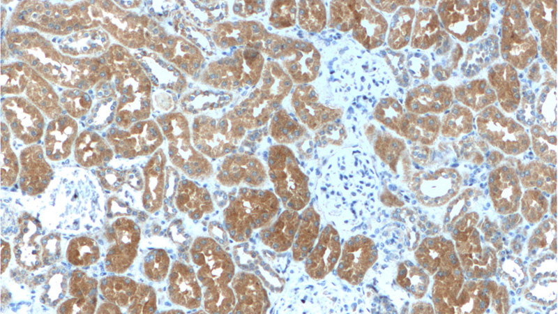 Immunohistochemistry of paraffin-embedded human kidney tissue slide using Catalog No:111641(NFKBIA Antibody) at dilution of 1:200 (under 10x lens).