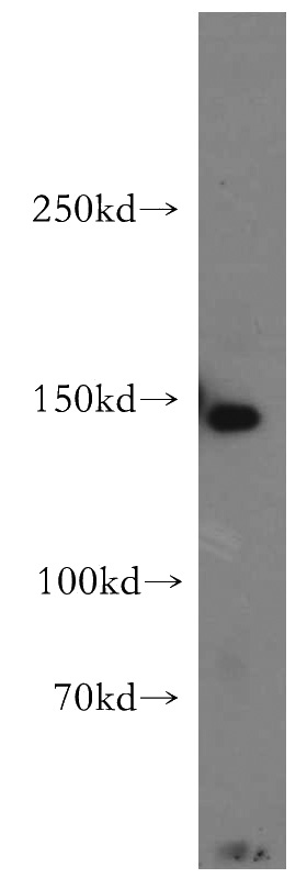 HepG2 cells were subjected to SDS PAGE followed by western blot with Catalog No:110595(FAM62A antibody) at dilution of 1:500