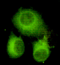 Immunocytochemistry of HeLa cells using anti-ATP-Citrate Lyase (C-terminus) mouse mAb diluted 1:150.