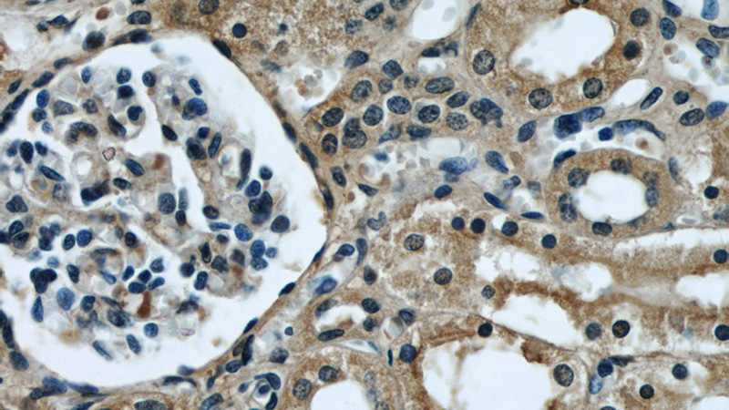Immunohistochemical of paraffin-embedded human kidney using Catalog No:107528(APCS antibody) at dilution of 1:50 (under 40x lens)