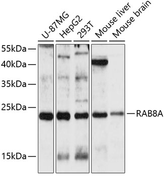 Western blot - RAB8A Polyclonal Antibody 