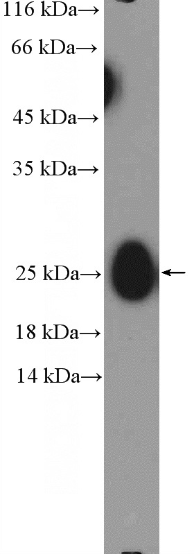 human plasma (0.3 ug) tissue were subjected to SDS PAGE followed by western blot with Catalog No:111693(IgG light chain Antibody) at dilution of 1:1000