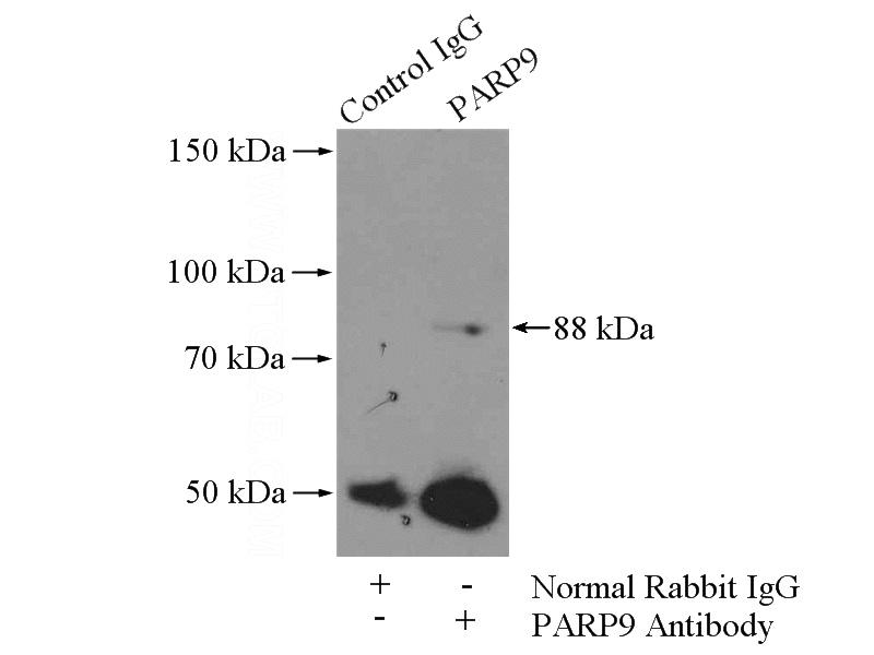 IP Result of anti-PARP9 (IP:Catalog No:113596, 4ug; Detection:Catalog No:113596 1:500) with MCF-7 cells lysate 4000ug.