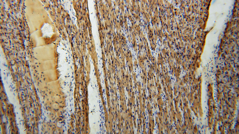 Immunohistochemical of paraffin-embedded human heart using Catalog No:112992(MB antibody) at dilution of 1:100 (under 10x lens)