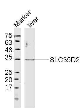Fig1: Sample: liver(Mouse)Lysate at 40 ug; Primary: Anti-SLC35D2 at 1/300 dilution; Secondary: IRDye800CW Goat Anti-RabbitIgG at 1/20000 dilution; Predicted band size: 37kD; Observed band size: 35kD