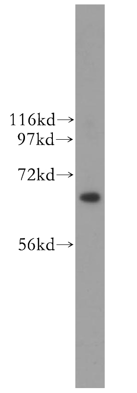 HeLa cells were subjected to SDS PAGE followed by western blot with Catalog No:109111(CDC6 antibody) at dilution of 1:400
