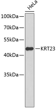 Western blot - KRT23 Polyclonal Antibody 