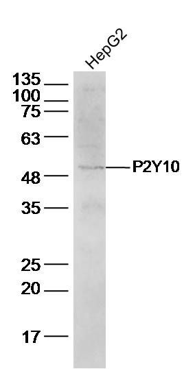 Fig1: Sample:; HepG2 cell(human) Lysate at 30 ug; Primary: Anti-P2Y10 at 1/500 dilution; Secondary: IRDye800CW Goat Anti-Rabbit IgG at 1/20000 dilution; Predicted band size: 39kD; Observed band size: 49 kD
