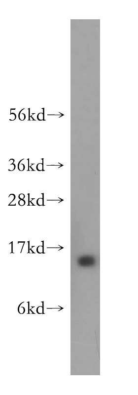 HeLa cells were subjected to SDS PAGE followed by western blot with Catalog No:111488(HMGN4 antibody) at dilution of 1:400