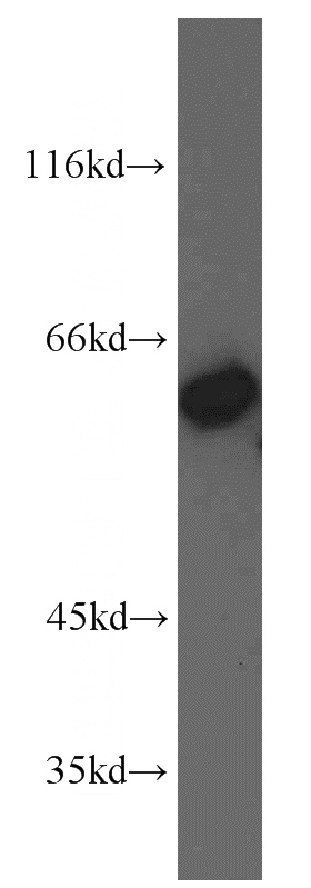 A549 cells were subjected to SDS PAGE followed by western blot with Catalog No:111785(IMPDH2 antibody) at dilution of 1:500