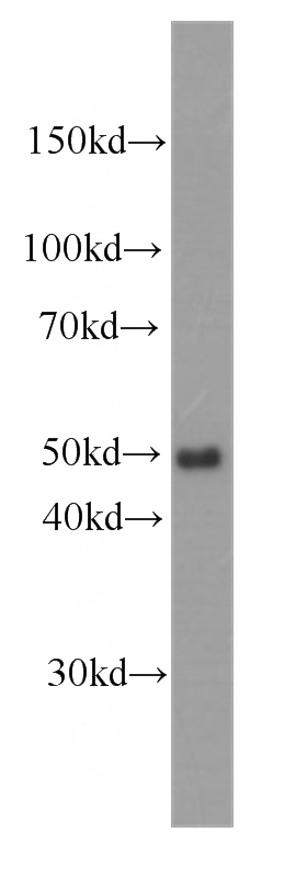 RAW264.7 cells were subjected to SDS PAGE followed by western blot with Catalog No:107044(CD14 antibody) at dilution of 1:500