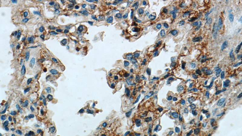 Immunohistochemical of paraffin-embedded human lung using Catalog No:113915(PIP5K1B antibody) at dilution of 1:100 (under 40x lens)