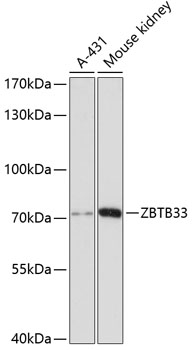 Western blot - ZBTB33 Polyclonal Antibody 