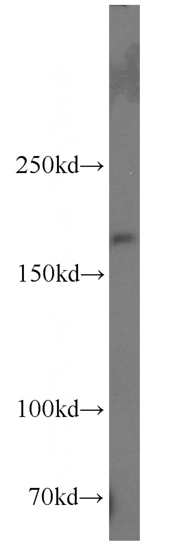 rat brain tissue were subjected to SDS PAGE followed by western blot with Catalog No:113115(NES antibody) at dilution of 1:1000