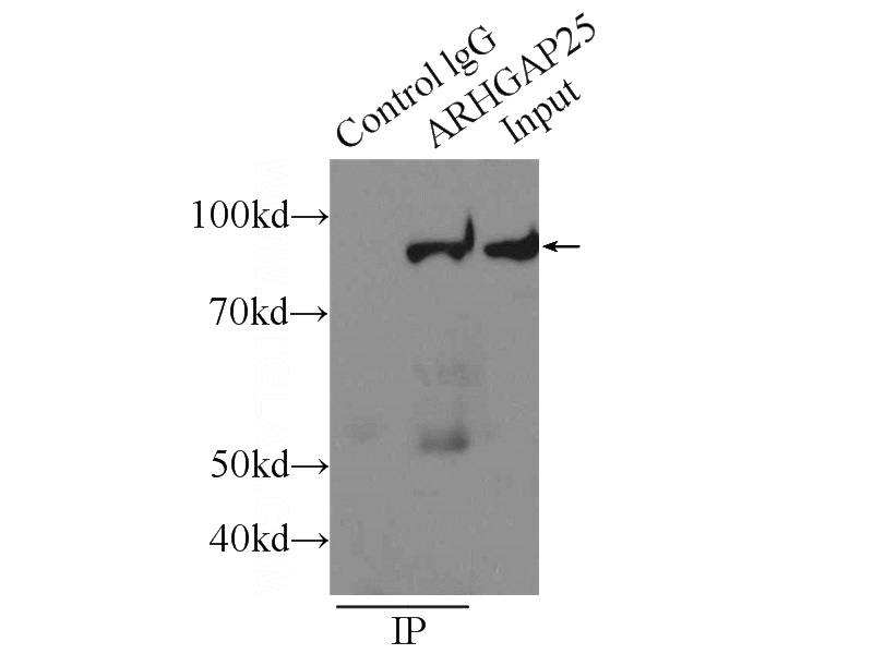 IP Result of anti-ARHGAP25 (IP:Catalog No:108265, 4ug; Detection:Catalog No:108265 1:500) with Jurkat cells lysate 1000ug.