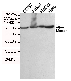 Western blot detection of Moesin in COS7,Jurkat,HaCat and Hela cell lysates using Moesin mouse mAb (dilution 1:1000).Predicted band size:67.8KDa.Observed band size:67.8KDa.