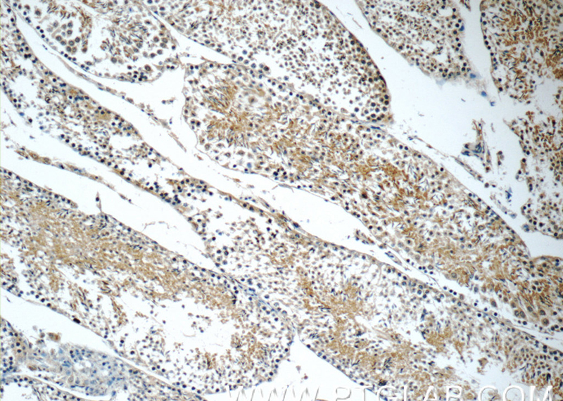 Immunohistochemistry of paraffin-embedded mouse testis tissue slide using Catalog No:110756(FXYD4 Antibody) at dilution of 1:50 (under 10x lens)