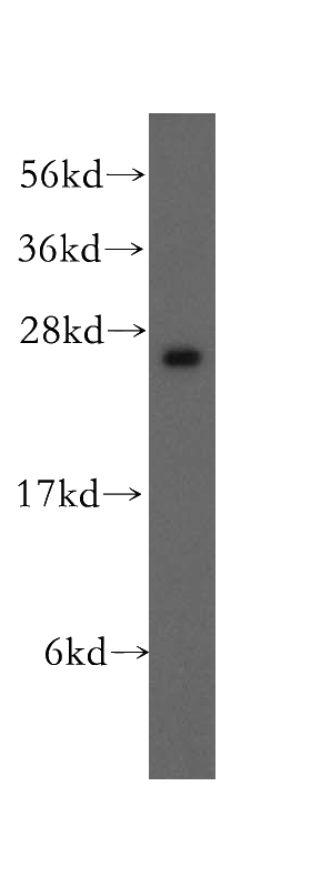 HeLa cells were subjected to SDS PAGE followed by western blot with Catalog No:116672(UCHL3 antibody) at dilution of 1:500