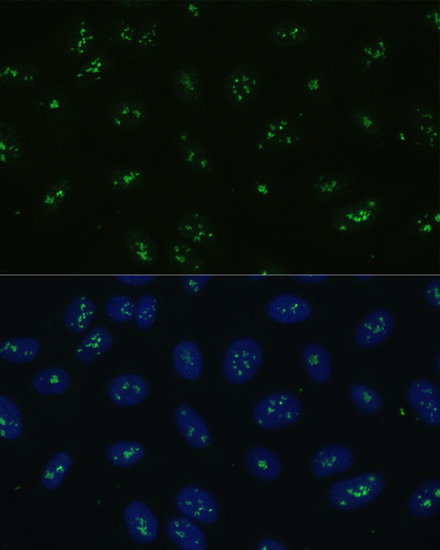 Immunofluorescence - NOLC1 Polyclonal Antibody 