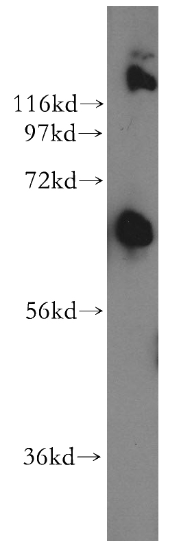 mouse testis tissue were subjected to SDS PAGE followed by western blot with Catalog No:112177(LCORL antibody) at dilution of 1:500